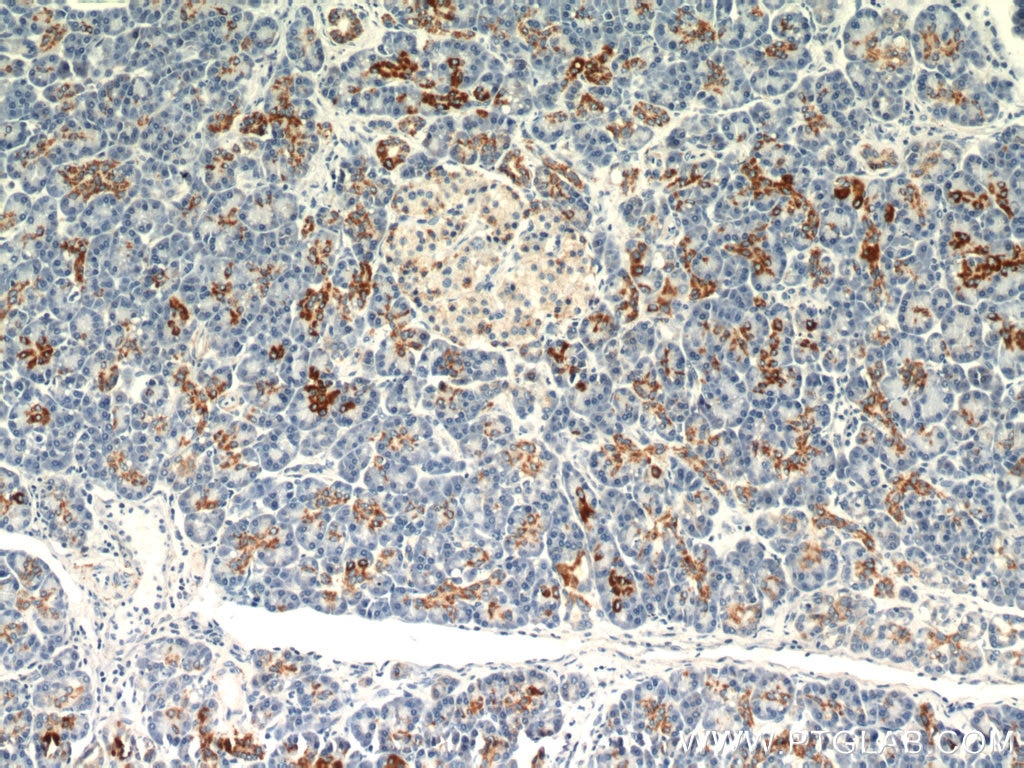 Immunohistochemistry (IHC) staining of human pancreas tissue using MAOA Polyclonal antibody (10539-1-AP)