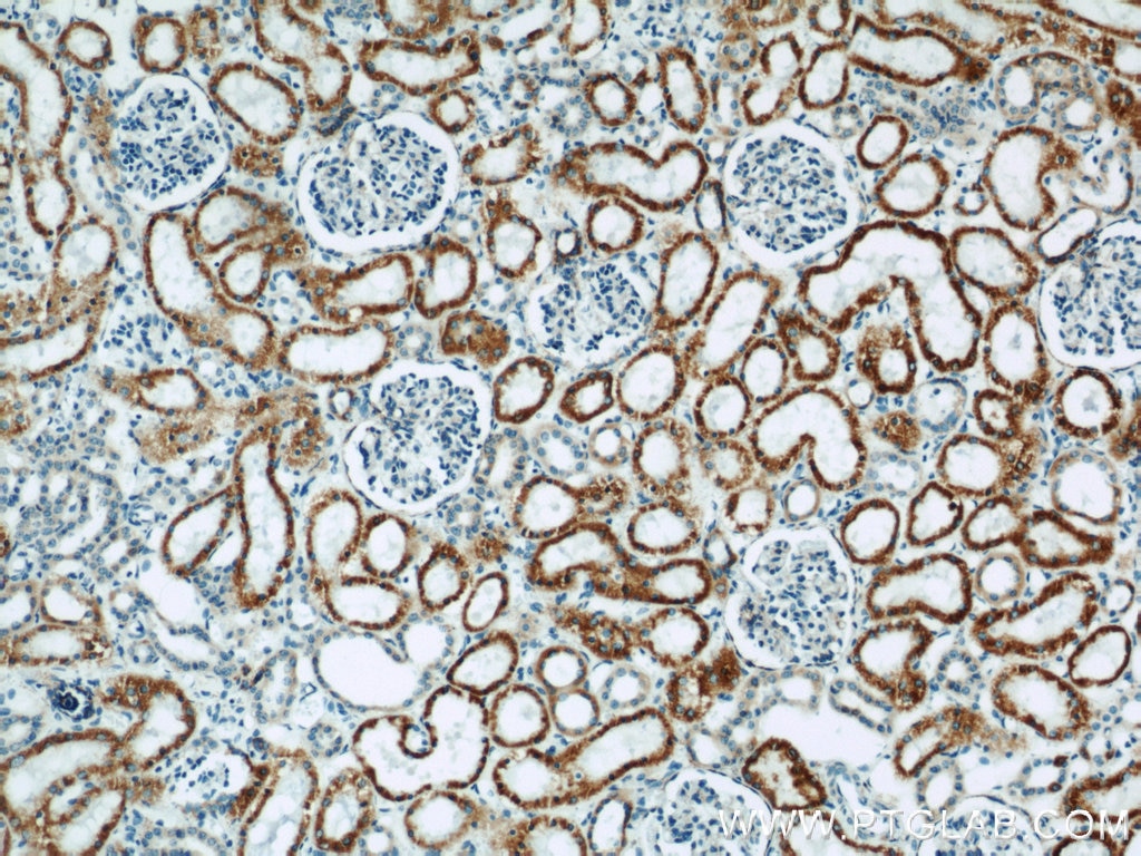 Immunohistochemistry (IHC) staining of human kidney tissue using MAOA Polyclonal antibody (10539-1-AP)