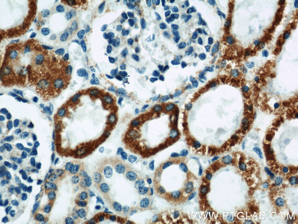 Immunohistochemistry (IHC) staining of human kidney tissue using MAOA Polyclonal antibody (10539-1-AP)