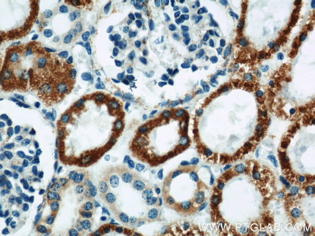 IHC staining of human kidney using 10539-1-AP