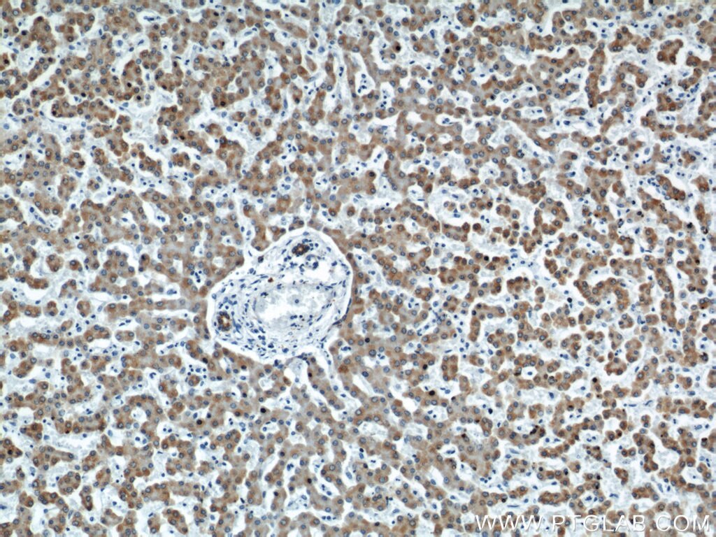 Immunohistochemistry (IHC) staining of human liver tissue using MAOA Polyclonal antibody (10539-1-AP)