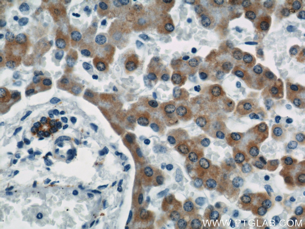 IHC staining of human liver using 10539-1-AP