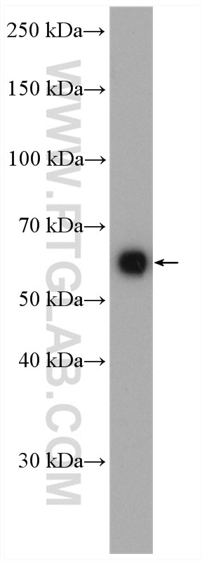 Western Blot (WB) analysis of LNCaP cells using MAOA Polyclonal antibody (10539-1-AP)