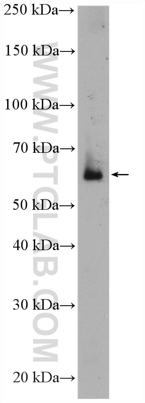 Western Blot (WB) analysis of human placenta tissue using MAOA Polyclonal antibody (10539-1-AP)