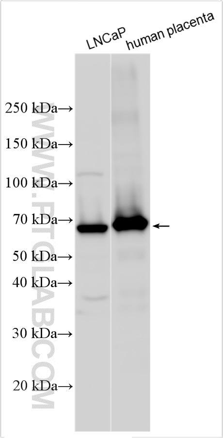 Western Blot (WB) analysis of various lysates using MAOA Polyclonal antibody (10539-1-AP)