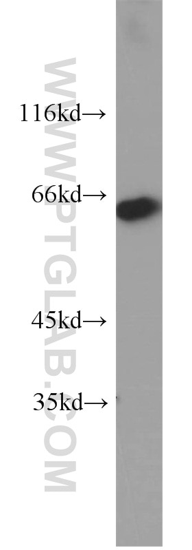 Western Blot (WB) analysis of human placenta tissue using MAOA Polyclonal antibody (10539-1-AP)