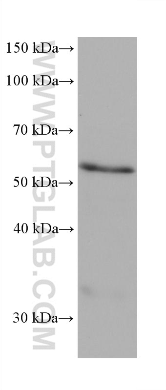 Western Blot (WB) analysis of U2OS cells using MAOA Monoclonal antibody (68471-1-Ig)