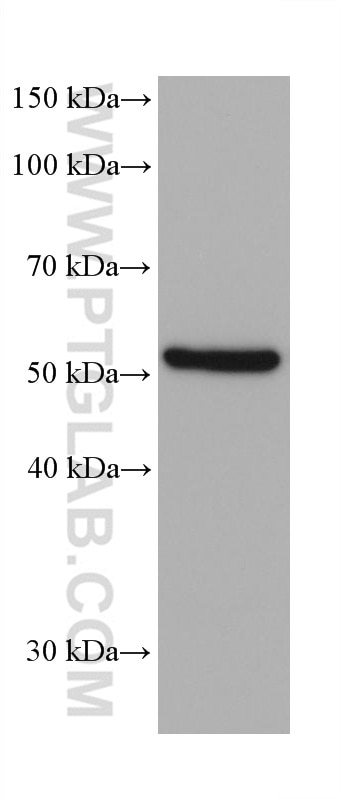 Western Blot (WB) analysis of LNCaP cells using MAOA Monoclonal antibody (68471-1-Ig)