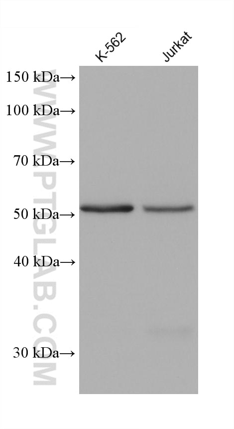 Western Blot (WB) analysis of various lysates using MAOA Monoclonal antibody (68471-1-Ig)