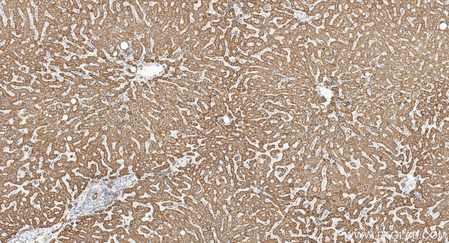 Immunohistochemistry (IHC) staining of human liver tissue using MAOB Polyclonal antibody (12602-1-AP)