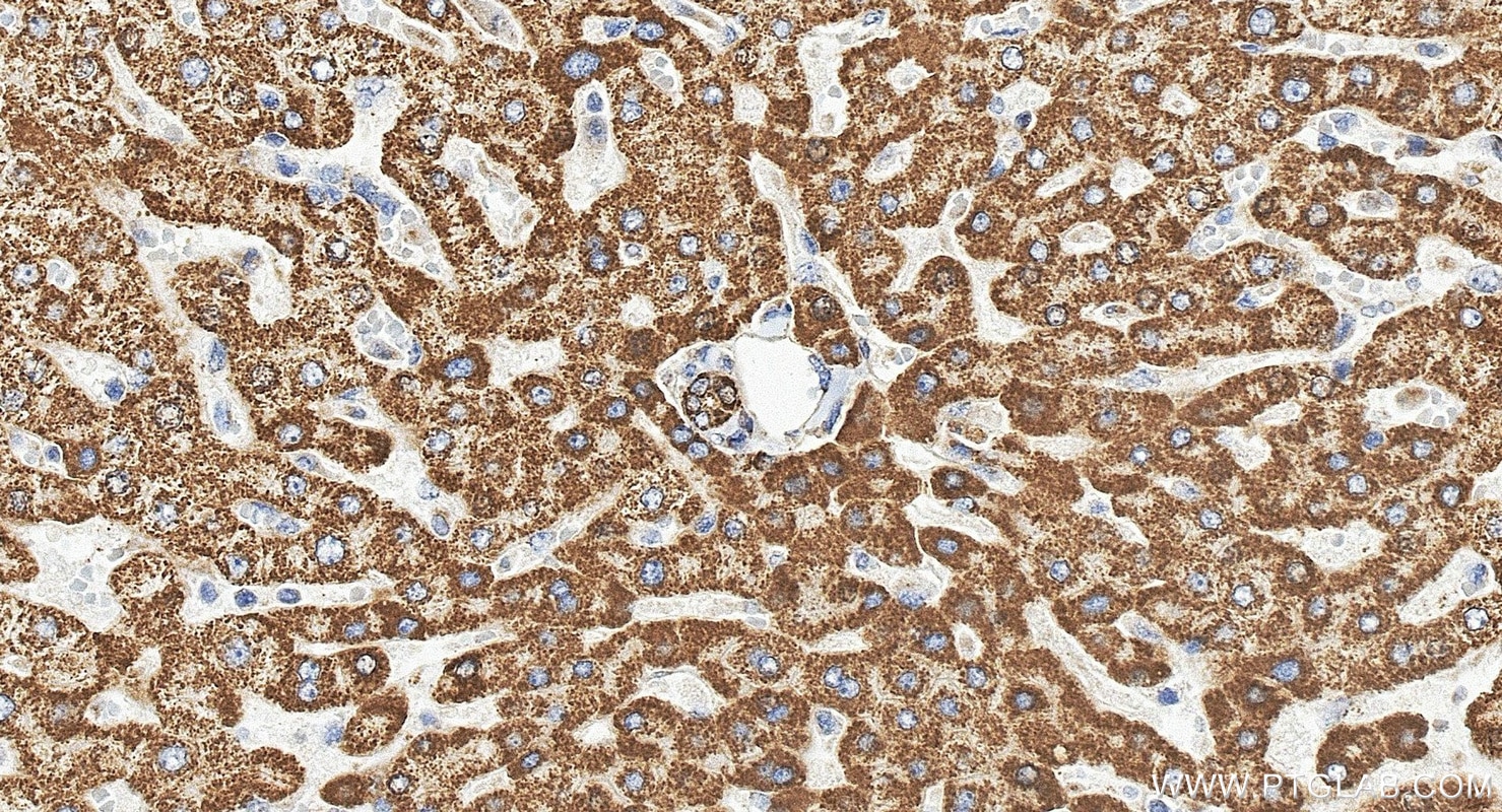 Immunohistochemistry (IHC) staining of human liver tissue using MAOB Polyclonal antibody (12602-1-AP)
