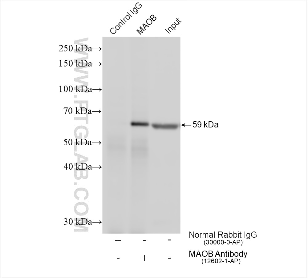 IP experiment of mouse liver using 12602-1-AP