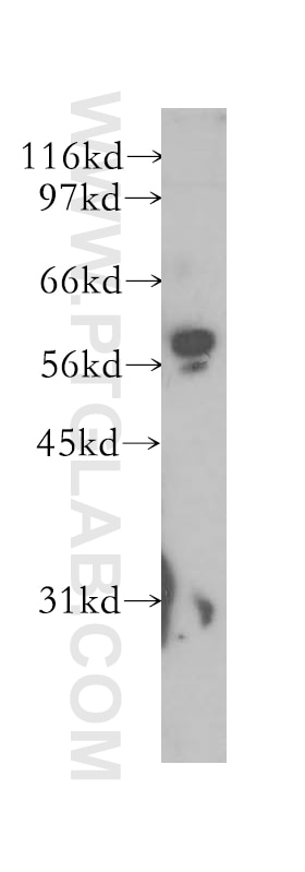 Western Blot (WB) analysis of human liver tissue using MAOB Polyclonal antibody (12602-1-AP)
