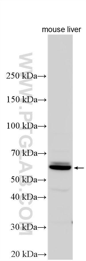 Western Blot (WB) analysis of various lysates using MAOB Polyclonal antibody (55263-1-AP)