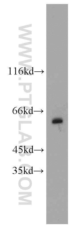 Western Blot (WB) analysis of mouse liver tissue using MAOB Polyclonal antibody (55263-1-AP)