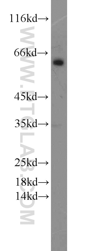 Western Blot (WB) analysis of mouse liver tissue using MAOB Polyclonal antibody (55263-1-AP)