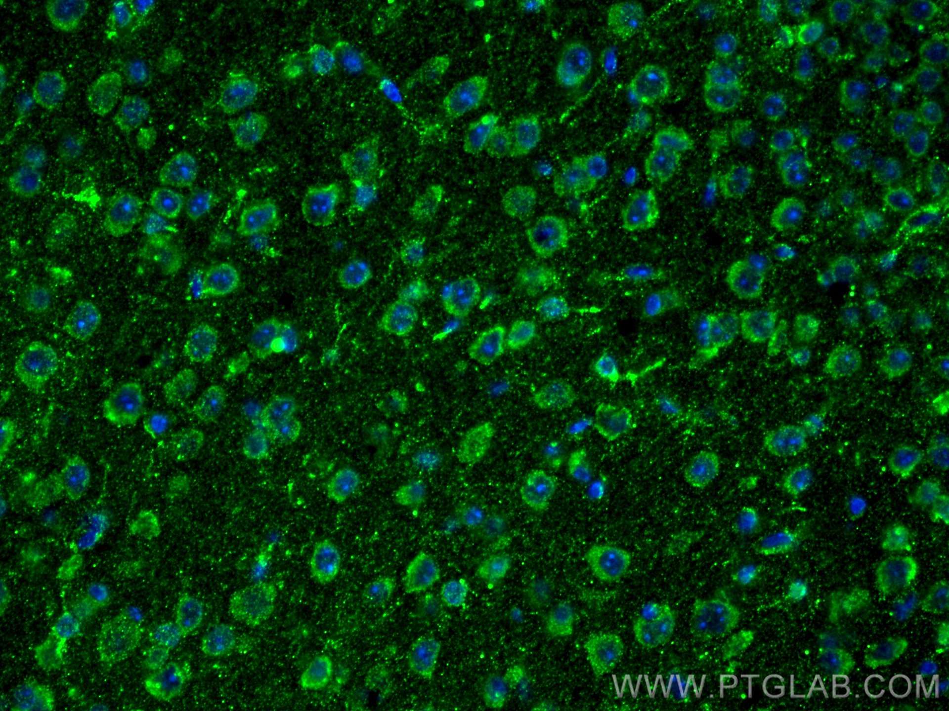 Immunofluorescence (IF) / fluorescent staining of mouse brain tissue using MAOB Monoclonal antibody (66107-1-Ig)