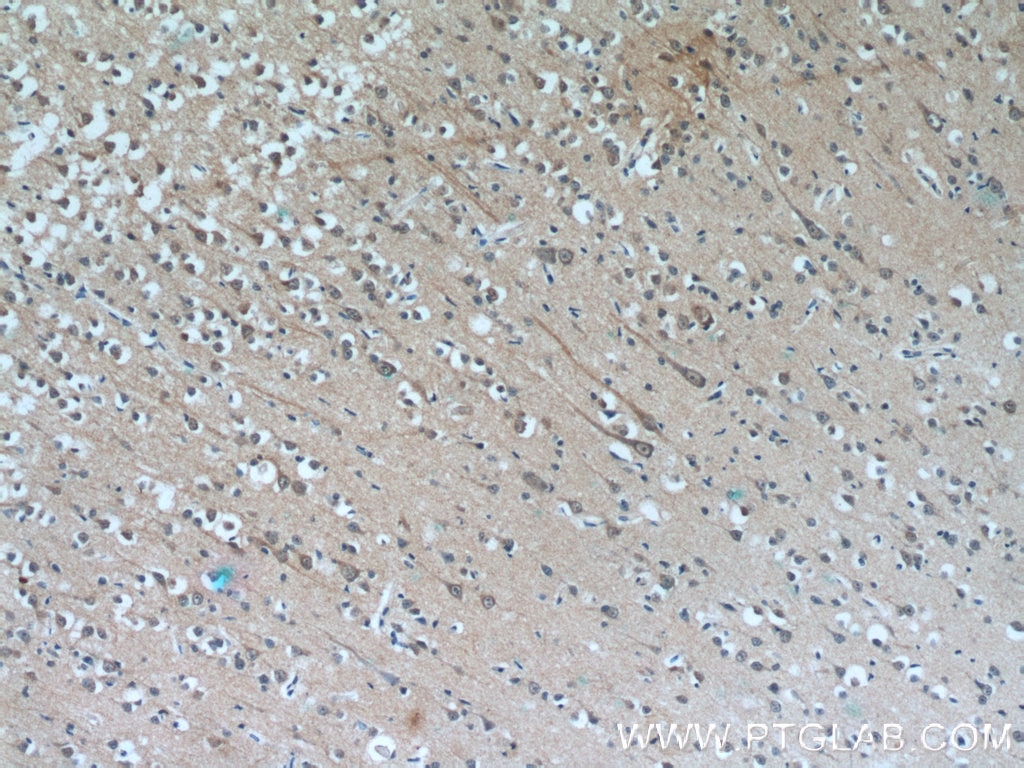 IHC staining of human brain using 66107-1-Ig