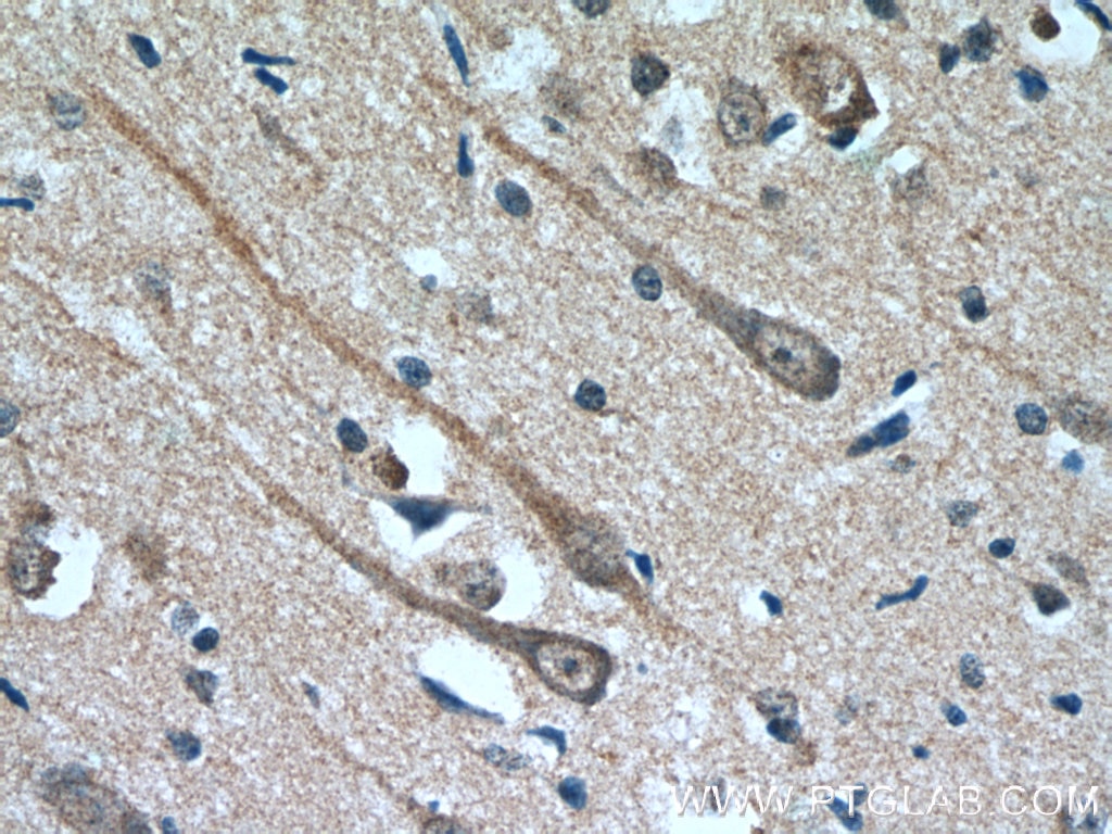 Immunohistochemistry (IHC) staining of human brain tissue using MAOB Monoclonal antibody (66107-1-Ig)