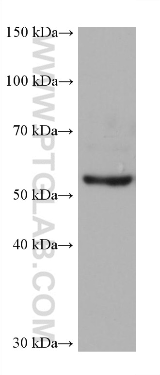 Western Blot (WB) analysis of HeLa cells using MAOB Monoclonal antibody (66107-1-Ig)