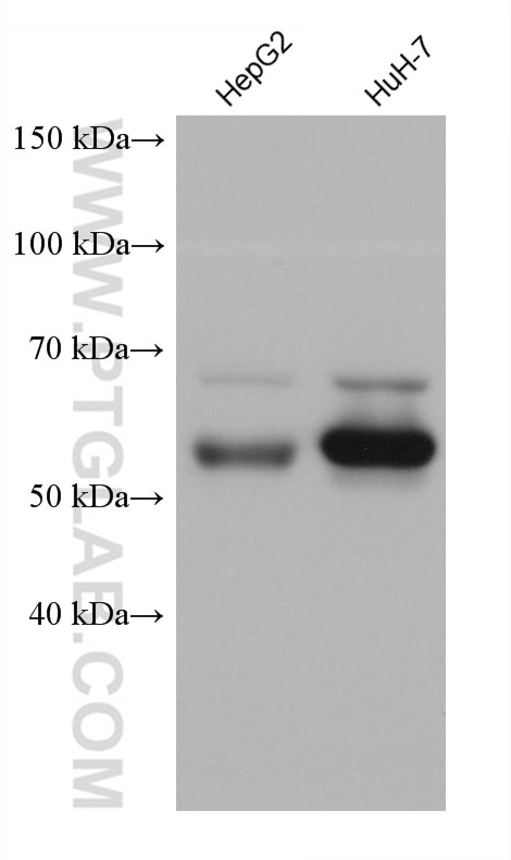 Western Blot (WB) analysis of various lysates using MAOB Monoclonal antibody (66107-1-Ig)