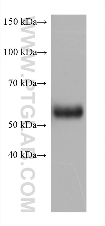 Western Blot (WB) analysis of fetal human brain tissue using MAOB Monoclonal antibody (66107-1-Ig)