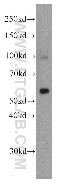 Western Blot (WB) analysis of human brain tissue using MAOB Monoclonal antibody (66107-1-Ig)