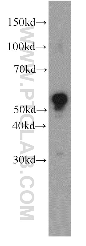 Western Blot (WB) analysis of human kidney tissue using MAOB Monoclonal antibody (66107-1-Ig)