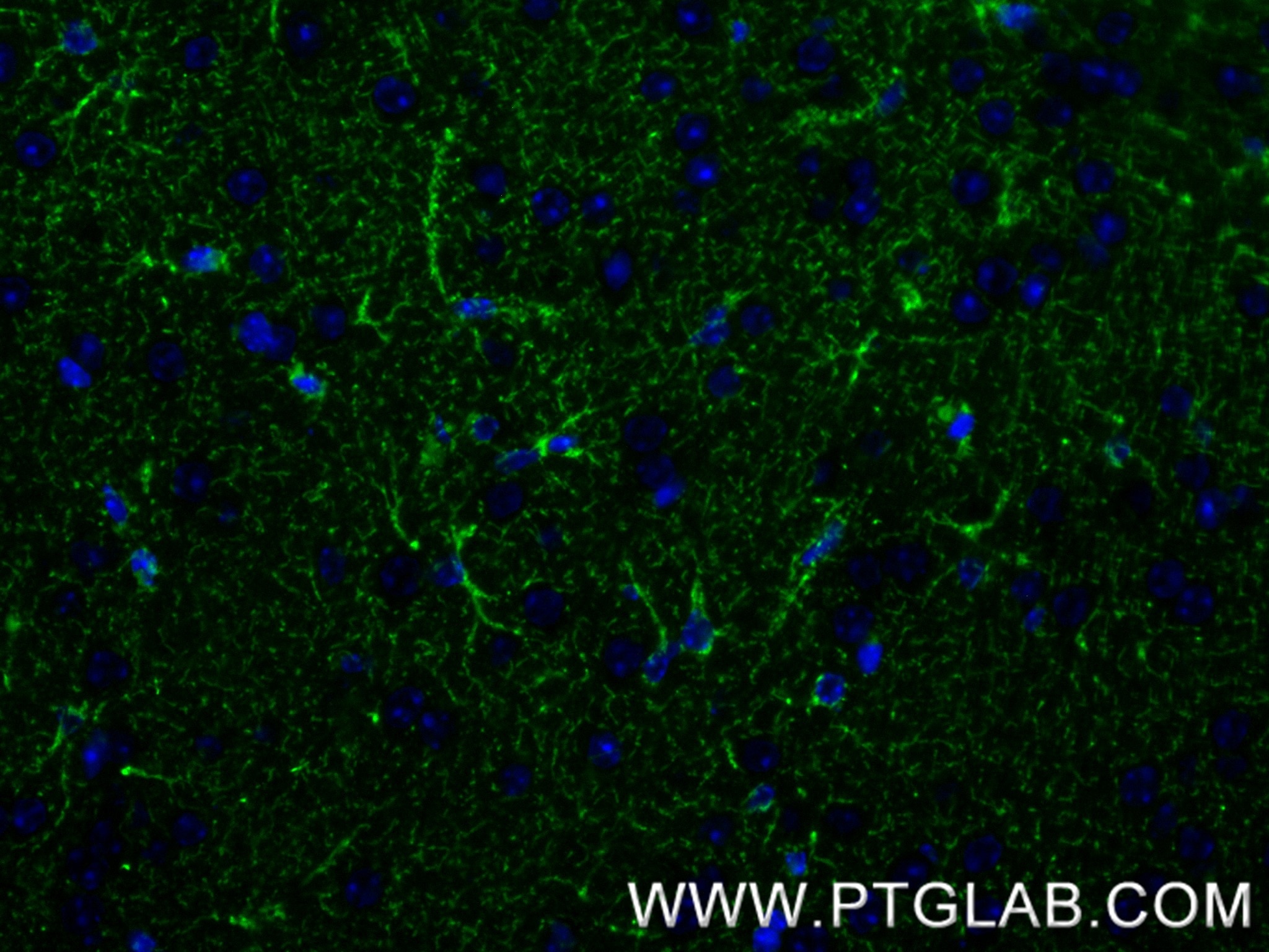 Immunofluorescence (IF) / fluorescent staining of mouse brain tissue using MAOB Recombinant monoclonal antibody (86695-1-RR)