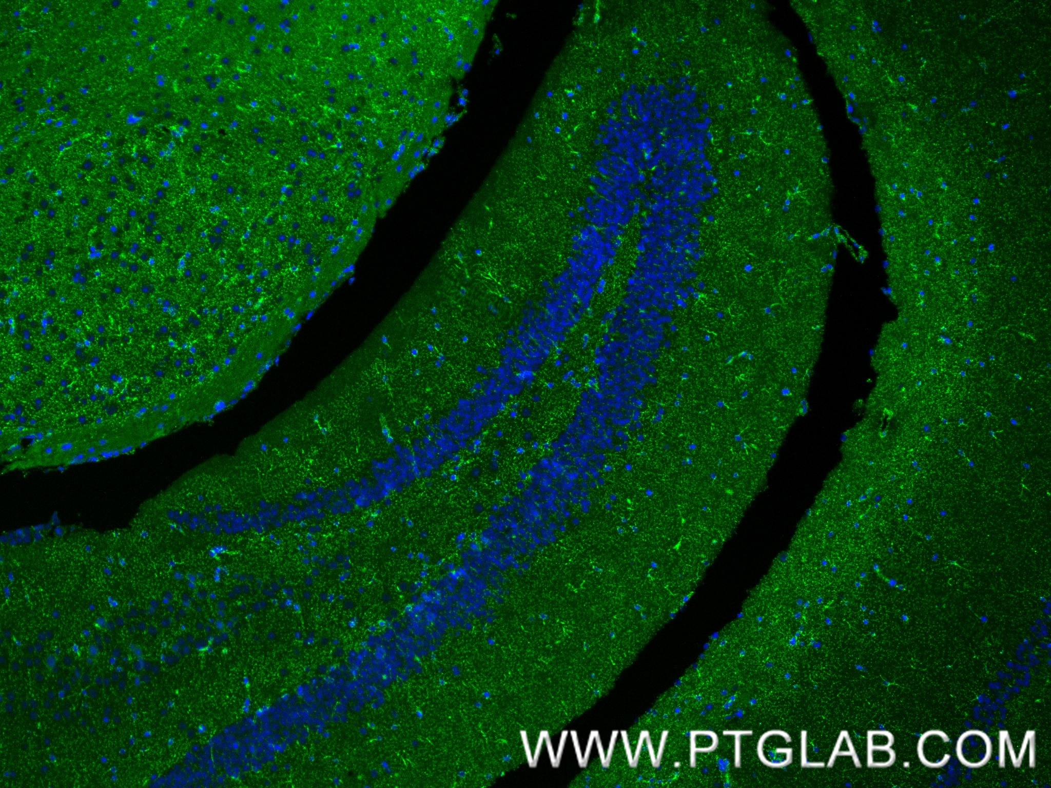 Immunofluorescence (IF) / fluorescent staining of mouse brain tissue using MAOB Recombinant monoclonal antibody (86695-1-RR)