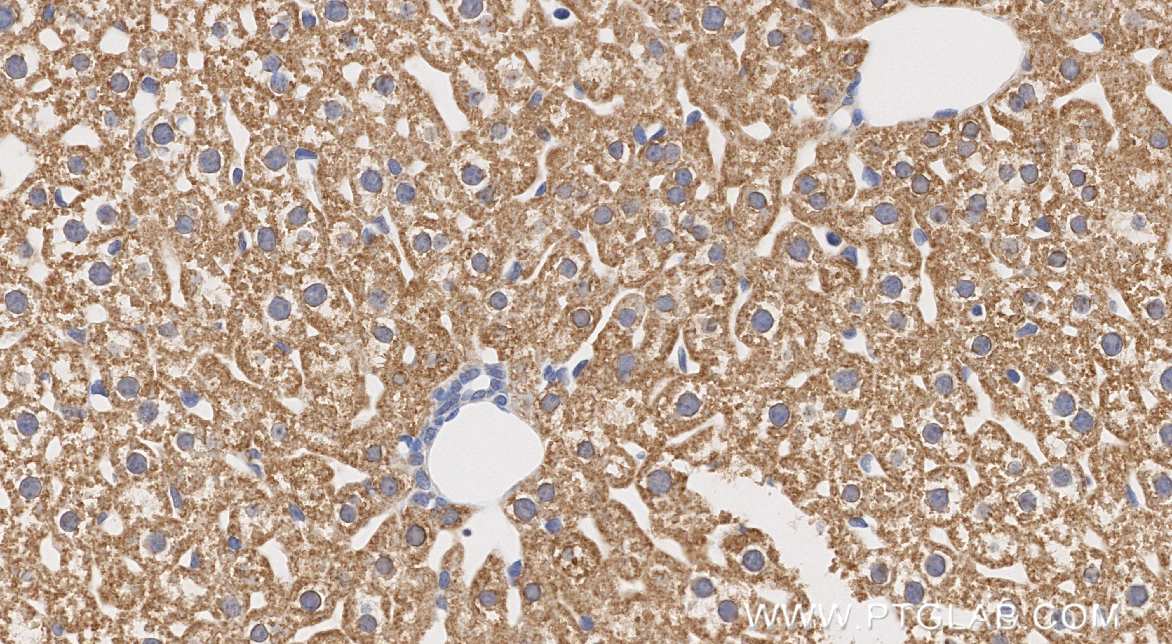 Immunohistochemical analysis of paraffin-embedded mouse liver tissue slide using 86695-1-RR (MAOB antibody) at dilution of 1:1000 (under 40x lens). Heat mediated antigen retrieval with Tris-EDTA buffer (pH 9.0). Immunohistochemistry (IHC) staining of mouse liver tissue using MAOB Recombinant monoclonal antibody (86695-1-RR)