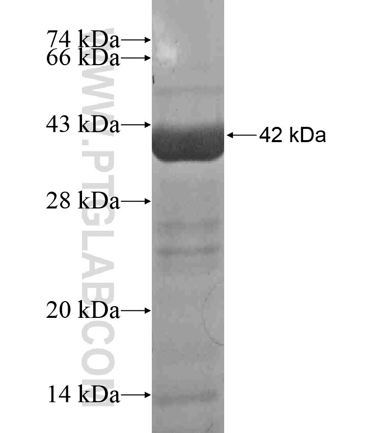 MAOB fusion protein Ag17918 SDS-PAGE