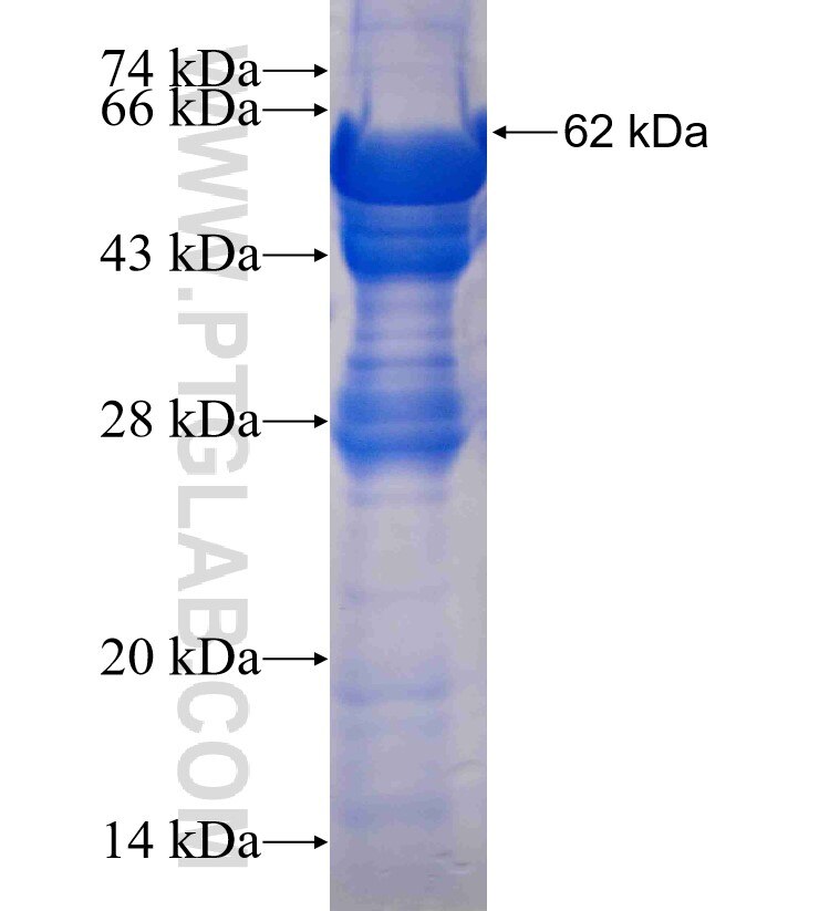 MAOB fusion protein Ag3253 SDS-PAGE