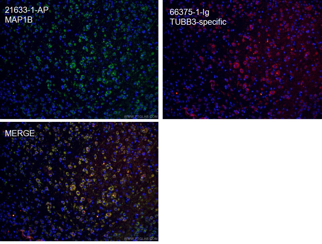 Immunofluorescence (IF) / fluorescent staining of mouse brain tissue using MAP1B Polyclonal antibody (21633-1-AP)
