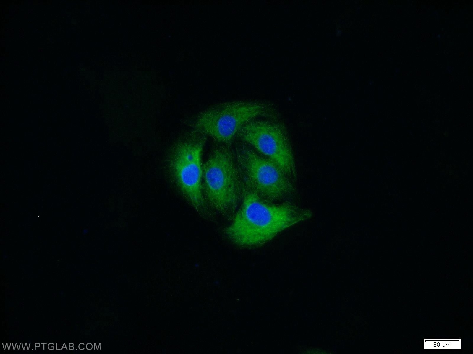 Immunofluorescence (IF) / fluorescent staining of SH-SY5Y cells using MAP1B Polyclonal antibody (21633-1-AP)