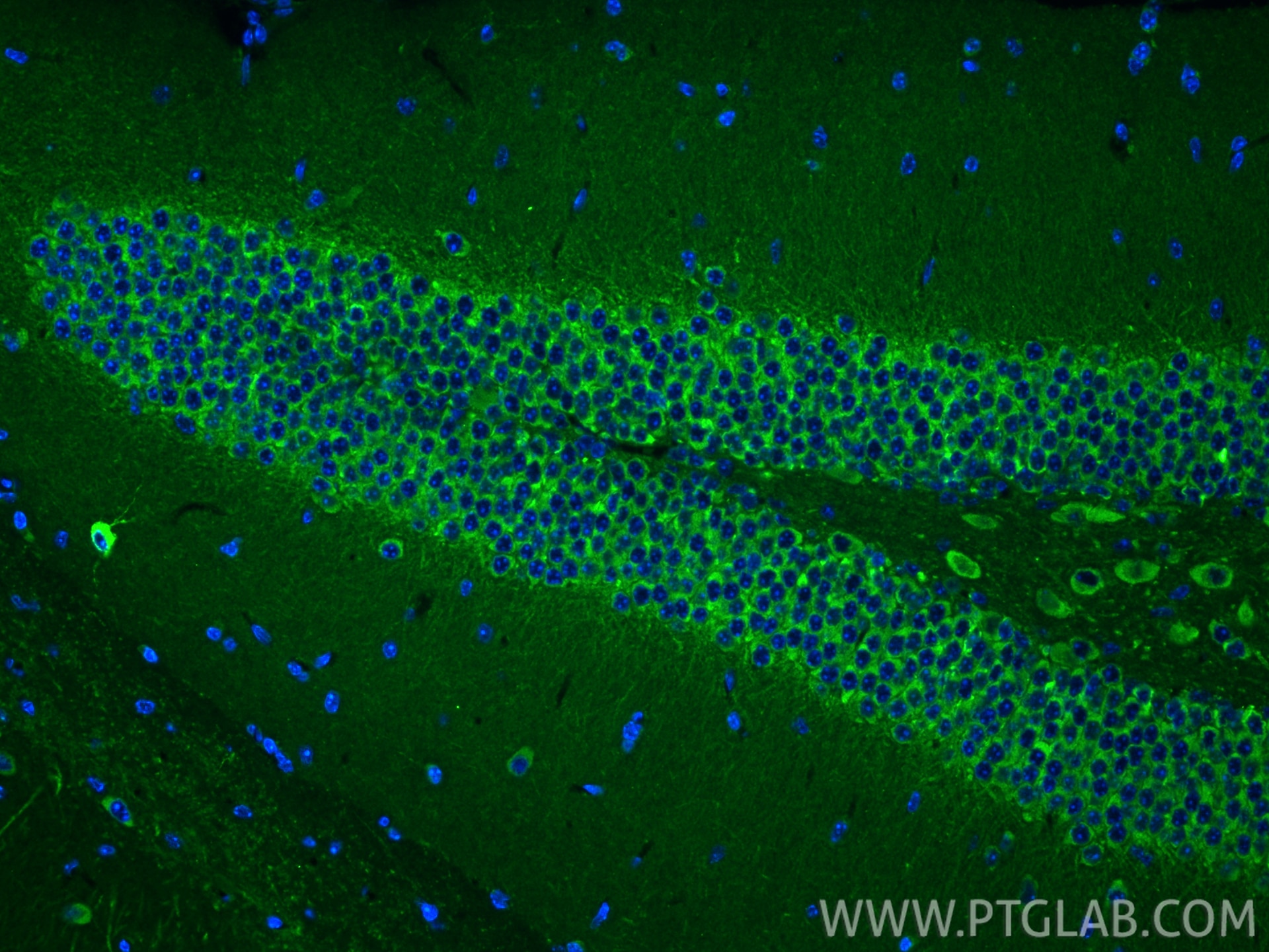 Immunofluorescence (IF) / fluorescent staining of mouse brain tissue using MAP1B Polyclonal antibody (21633-1-AP)