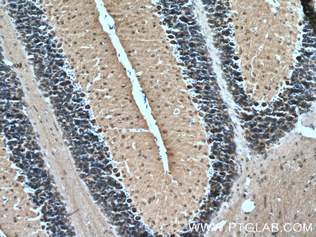 Immunohistochemistry (IHC) staining of mouse cerebellum tissue using MAP1B Polyclonal antibody (21633-1-AP)