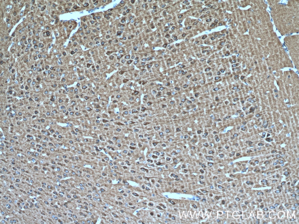 IHC staining of mouse brain using 21633-1-AP