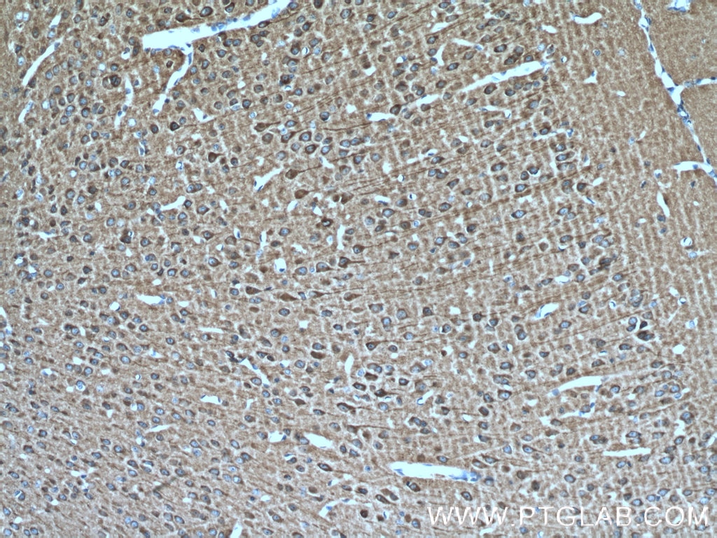 Immunohistochemistry (IHC) staining of mouse brain tissue using MAP1B Polyclonal antibody (21633-1-AP)