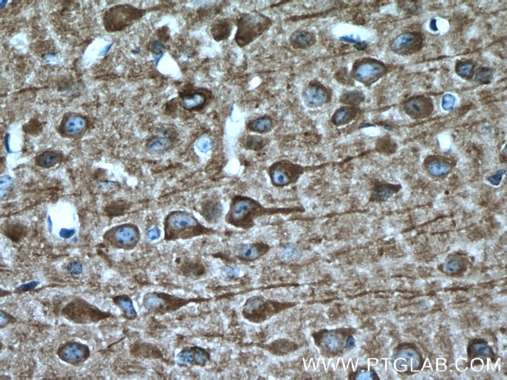 IHC staining of mouse brain using 21633-1-AP