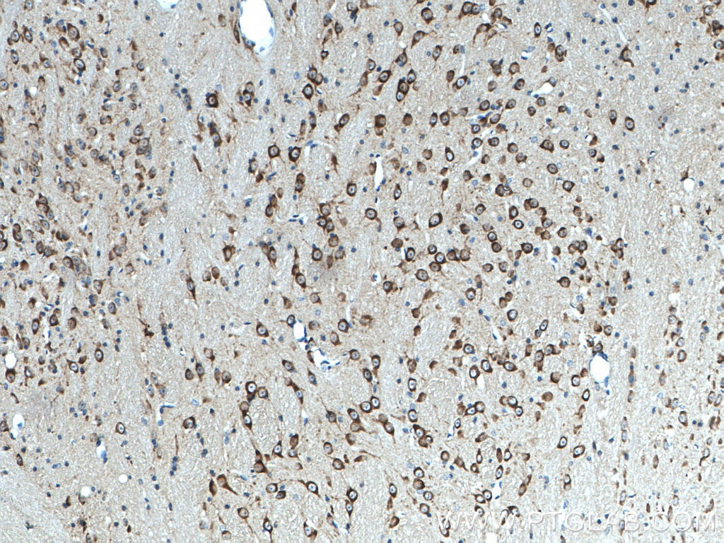 Immunohistochemistry (IHC) staining of mouse brain tissue using MAP1B Polyclonal antibody (21633-1-AP)