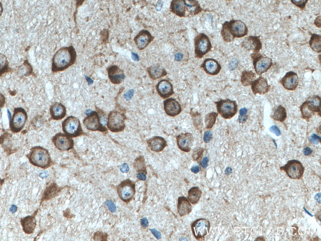 Immunohistochemistry (IHC) staining of mouse brain tissue using MAP1B Polyclonal antibody (21633-1-AP)