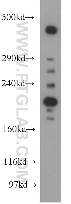 Western Blot (WB) analysis of human brain tissue using MAP1B Polyclonal antibody (21633-1-AP)