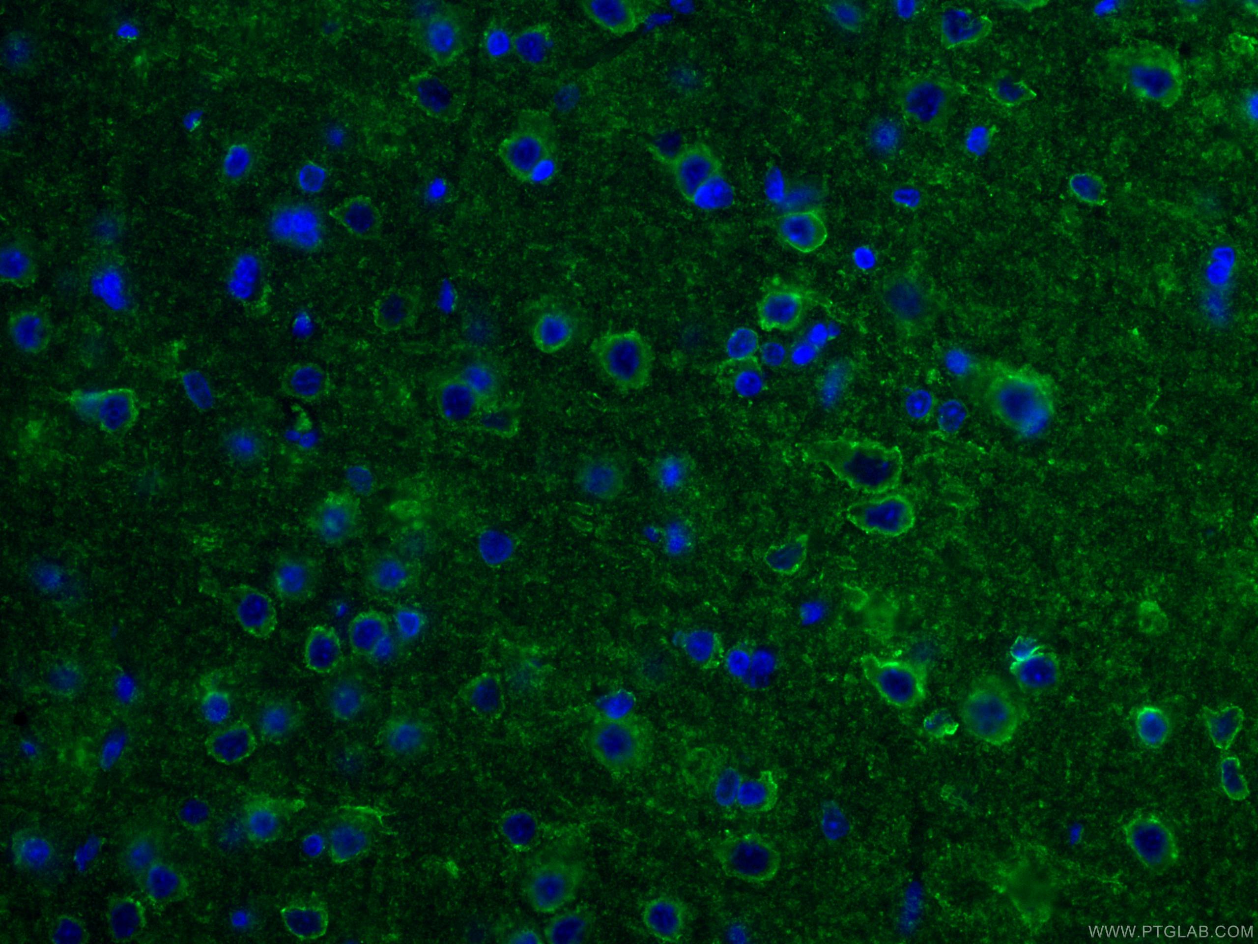 Immunofluorescence (IF) / fluorescent staining of rat brain tissue using MAP1B Monoclonal antibody (67423-1-Ig)