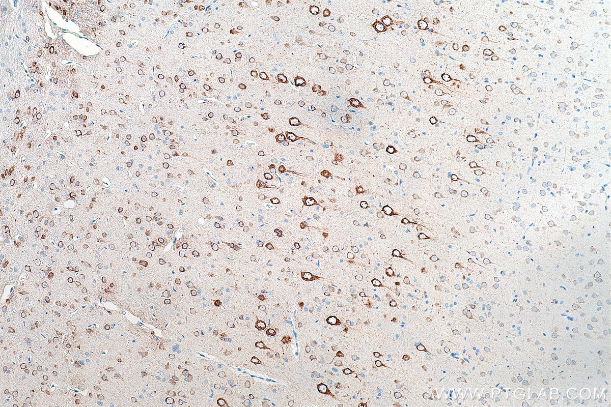 Immunohistochemistry (IHC) staining of rat brain tissue using MAP1B Monoclonal antibody (67423-1-Ig)