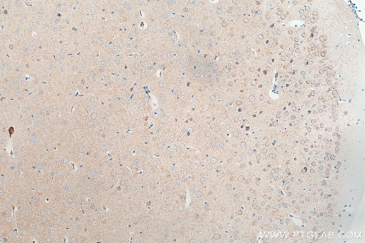 IHC staining of mouse brain using 67423-1-Ig