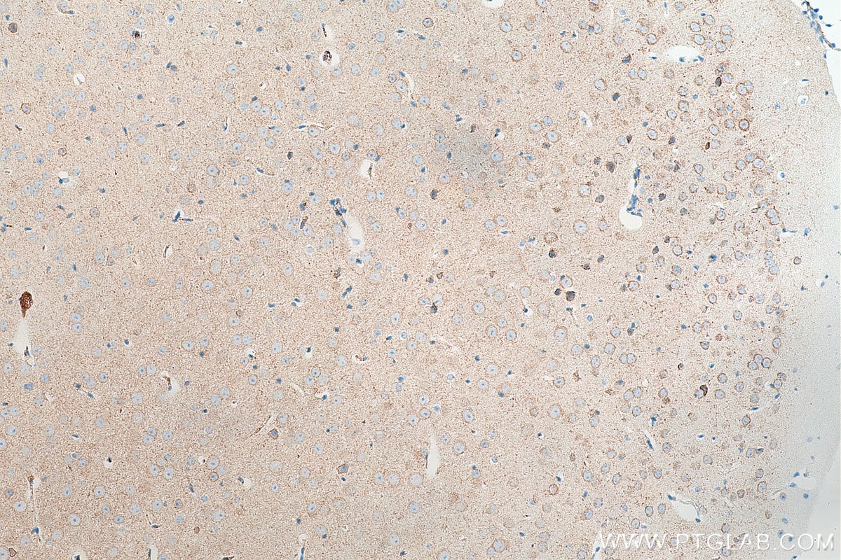 Immunohistochemistry (IHC) staining of mouse brain tissue using MAP1B Monoclonal antibody (67423-1-Ig)