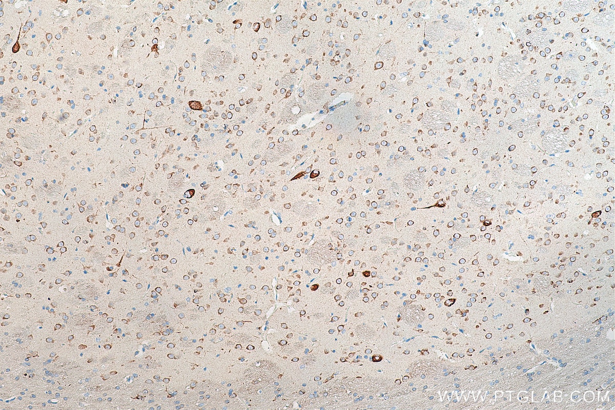 Immunohistochemistry (IHC) staining of rat brain tissue using MAP1B Monoclonal antibody (67423-1-Ig)