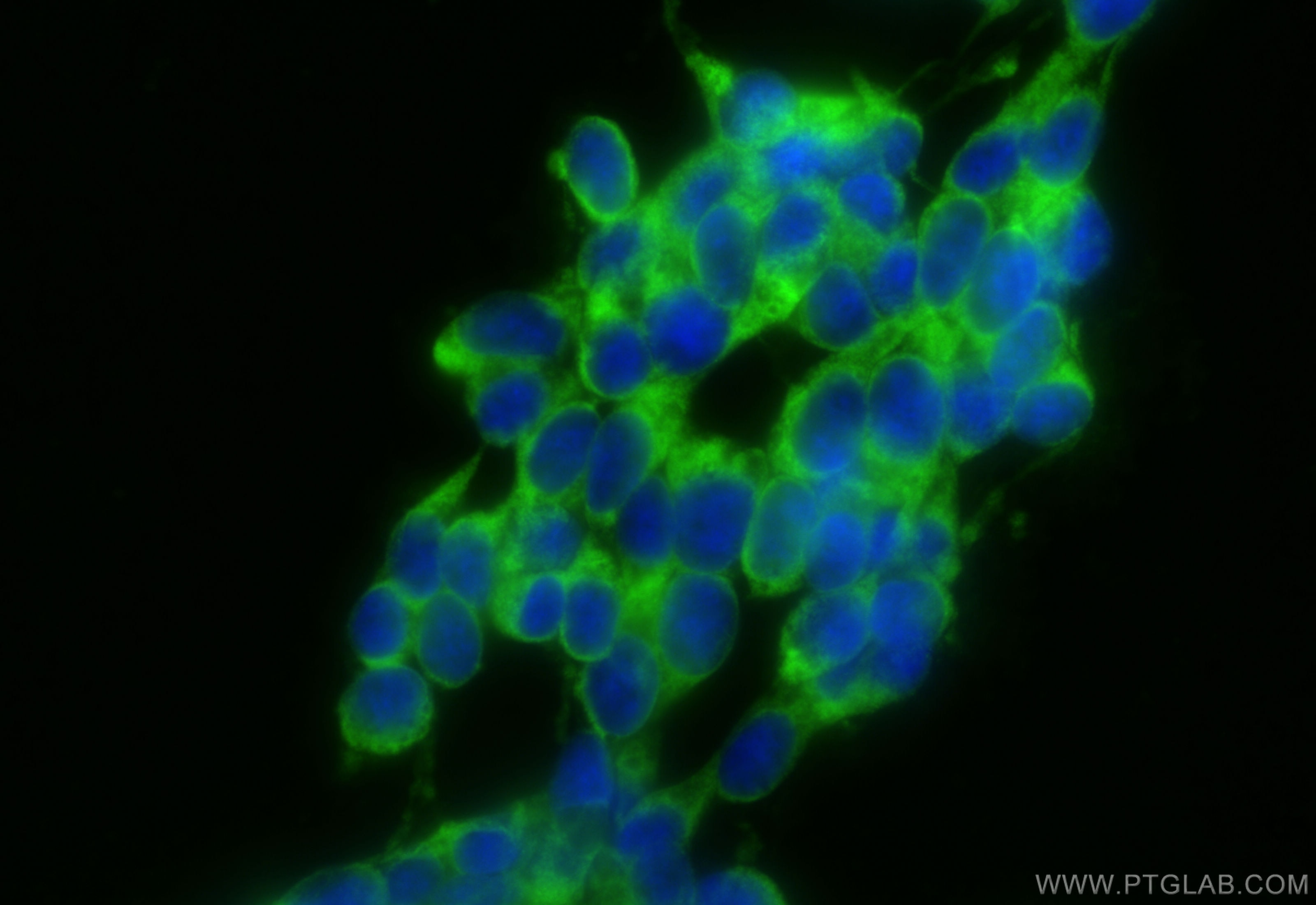 Immunofluorescent analysis of (-20°C Ethanol) fixed SH-SY5Y cells using CoraLite® Plus 488 MAP1B antibody (CL488-21633) at dilution of 1:200. Immunofluorescence (IF) / fluorescent staining of SH-SY5Y cells using CoraLite® Plus 488-conjugated MAP1B Polyclonal ant (CL488-21633)