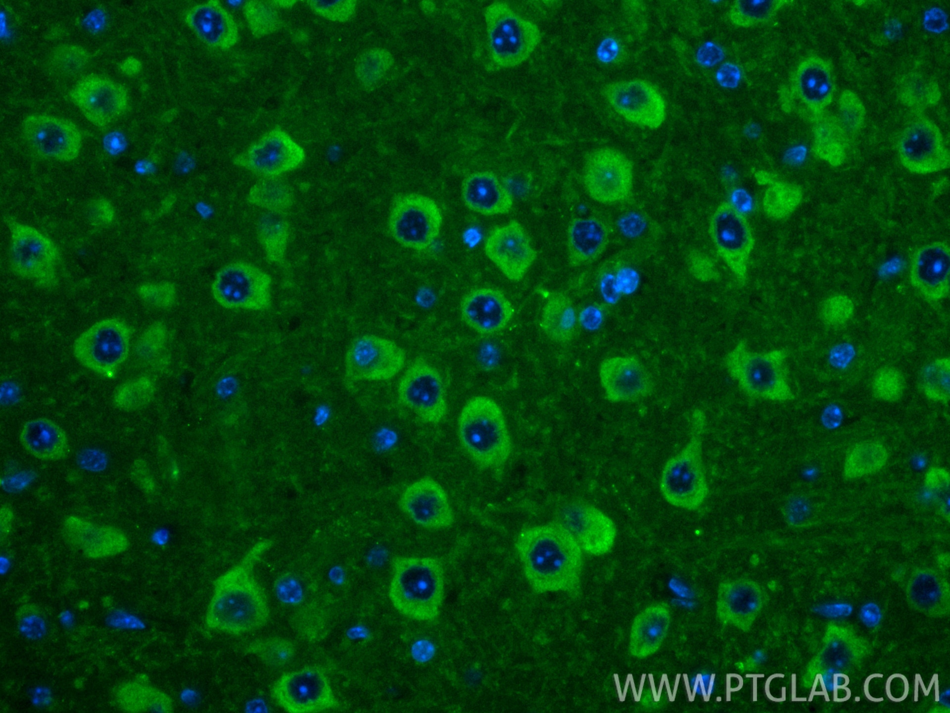 Immunofluorescent analysis of (4% PFA) fixed paraffin-embedded mouse brain tissue using CoraLite® Plus 488 MAP1B antibody (CL488-21633) at dilution of 1:200. Heat mediated antigen retrieval with Tris-EDTA buffer (pH 9.0). Immunofluorescence (IF) / fluorescent staining of mouse brain tissue using CoraLite® Plus 488-conjugated MAP1B Polyclonal ant (CL488-21633)